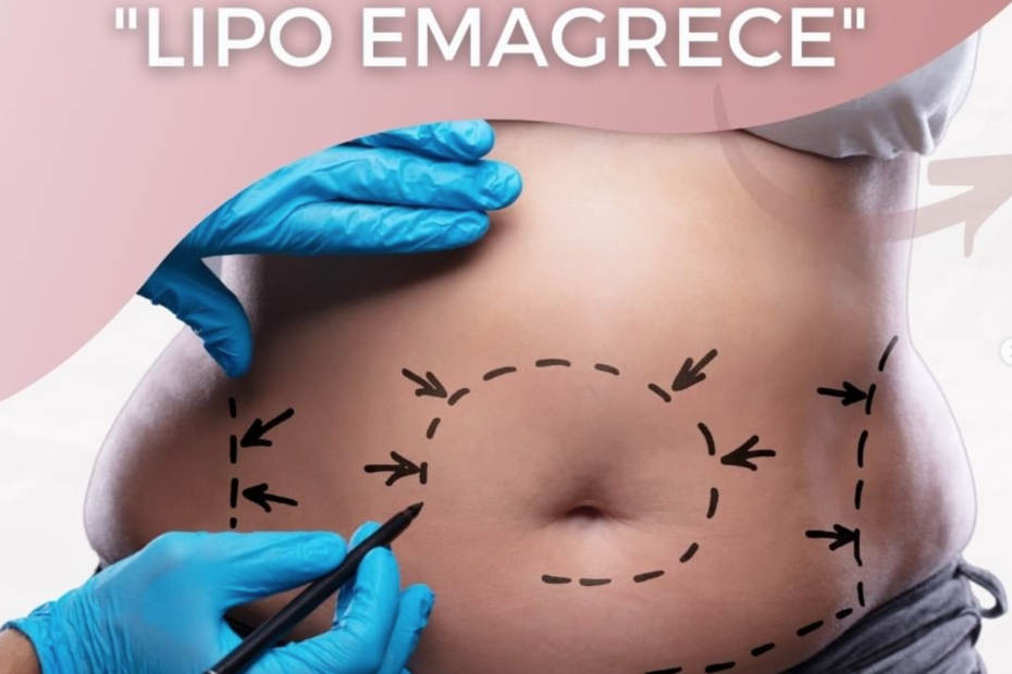 lipo emagrece